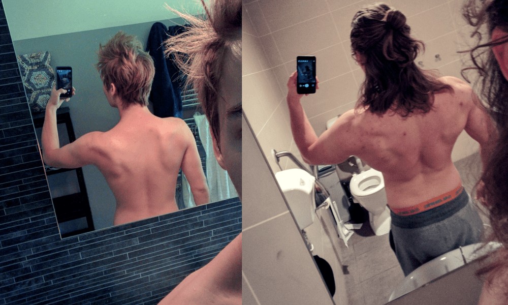 Back - before and after