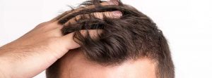 vegan hair loss header banner