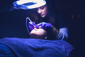 Is Microdermabrasion the Healthiest Option for Skin?