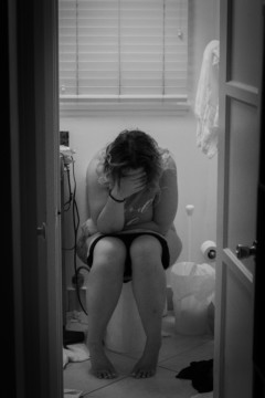 Best Exercises to Naturally Reduce Hemorrhoids